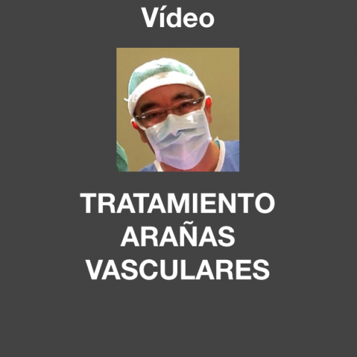 Tratamiento de arañas vasculares