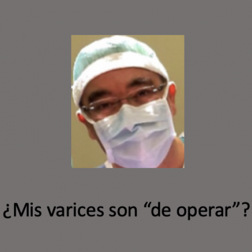 ¿Mis varices son de operar?